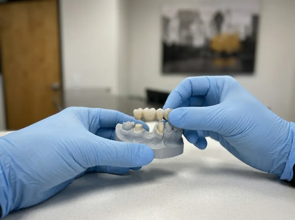 Dental Bridges Chandler