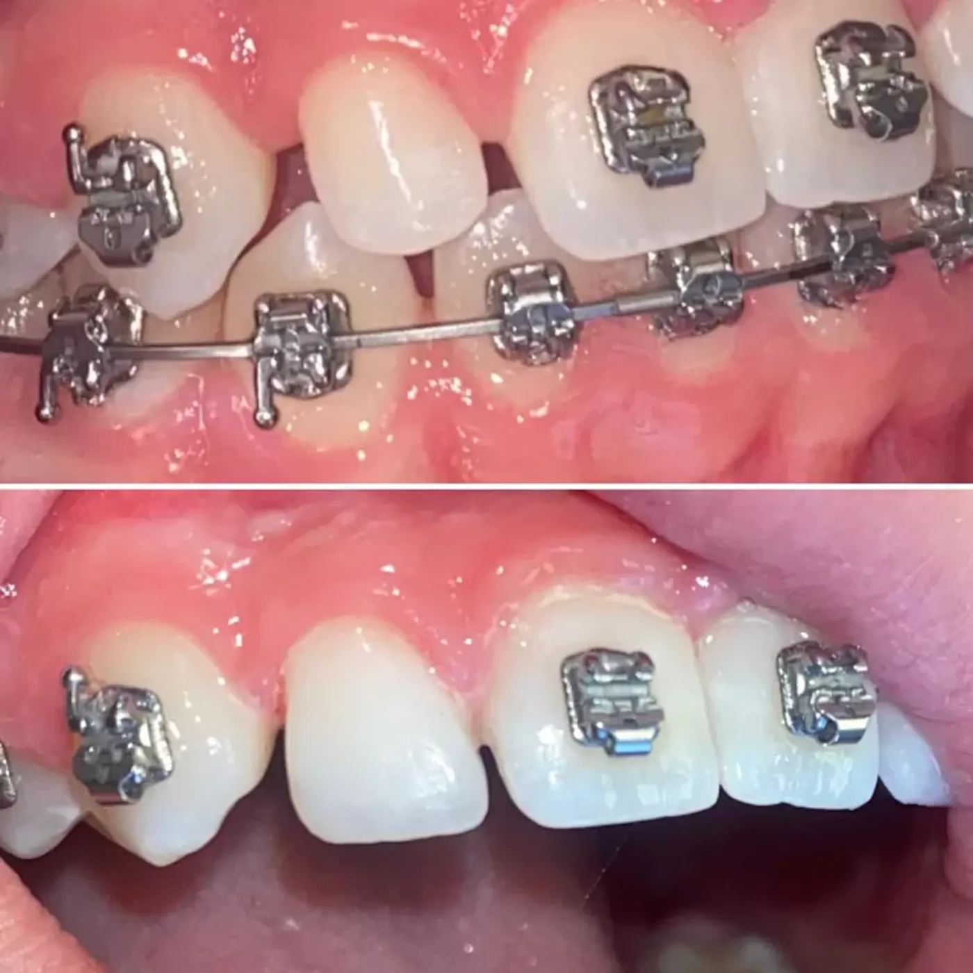 Smile gallery result from Valley Dental Solutions