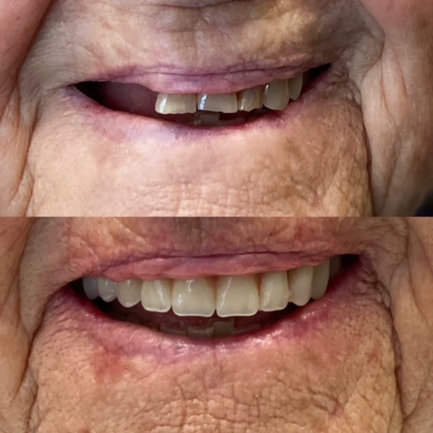 Practice smile transformation gallery image