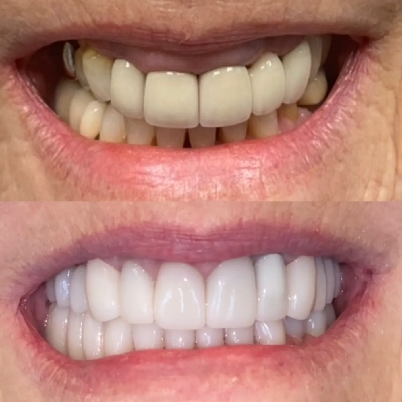 Practice smile transformation result in Chandler