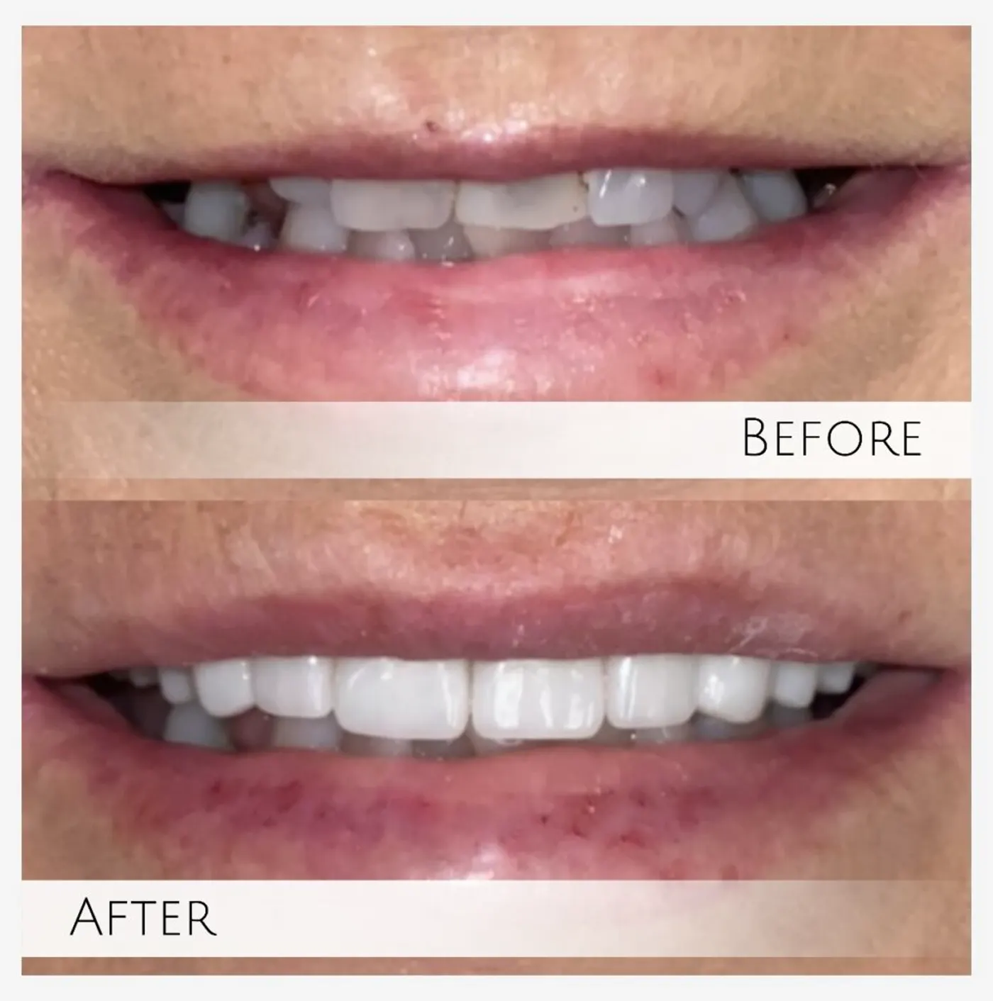 Smile gallery result from Valley Dental Solutions